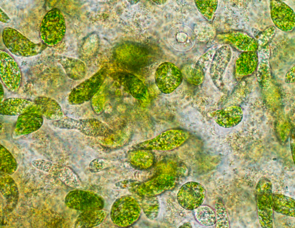 A photo of phytoplankton in a microscope slide.